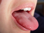 На які хвороби вказує стан язика ᐉ Народна Правда